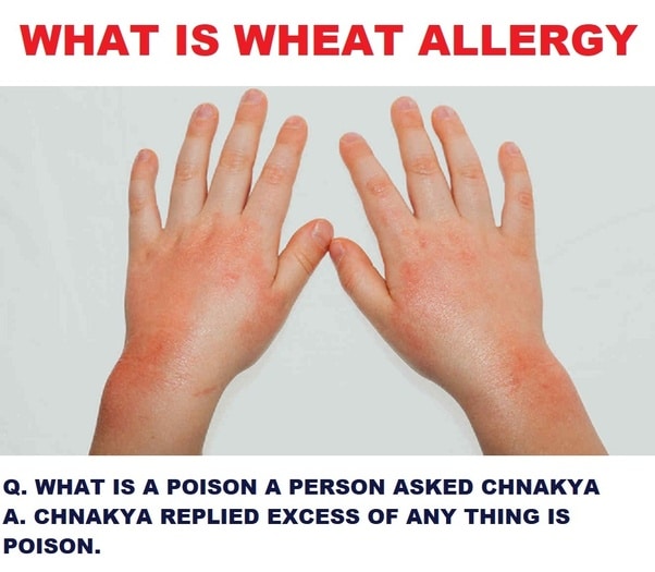 Why does the USA have nearly ten times more celiac disease, wheat ...